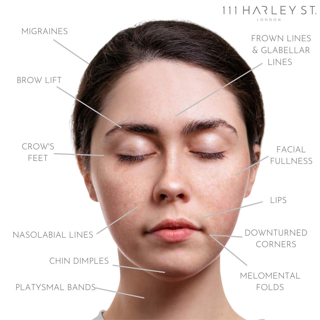 Botox London - Anti Wrinkle Injections & Treatments in Harley Street